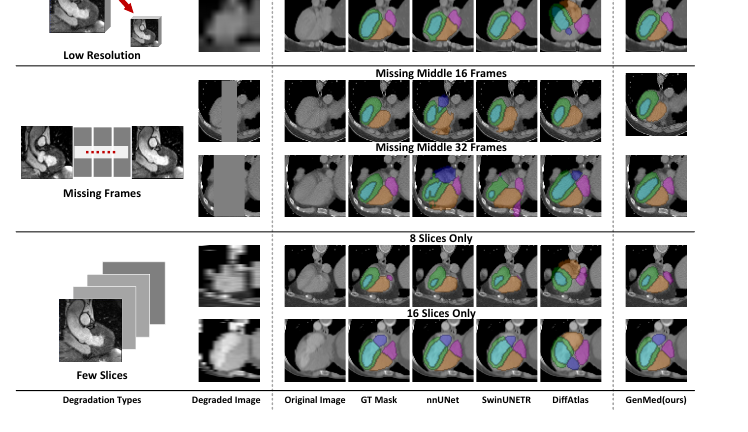 Segmentation under degraded inputs: low resolution, missing frames, and few slices.