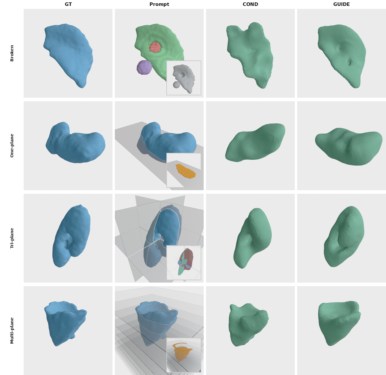 Comparison of ground truth, partial prompt, input-conditioning baseline, and GenMed guided result across four prompt types.