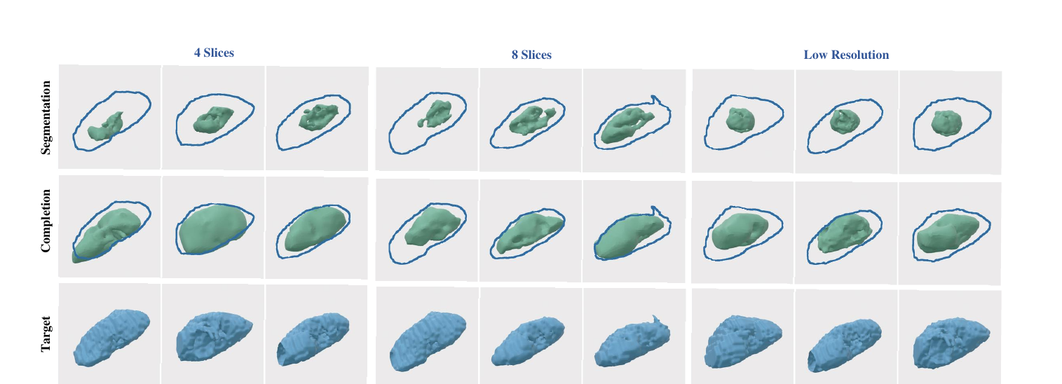 Two-stage diagnostic pipeline under different degradations: segmentation, completion, and ground-truth target.