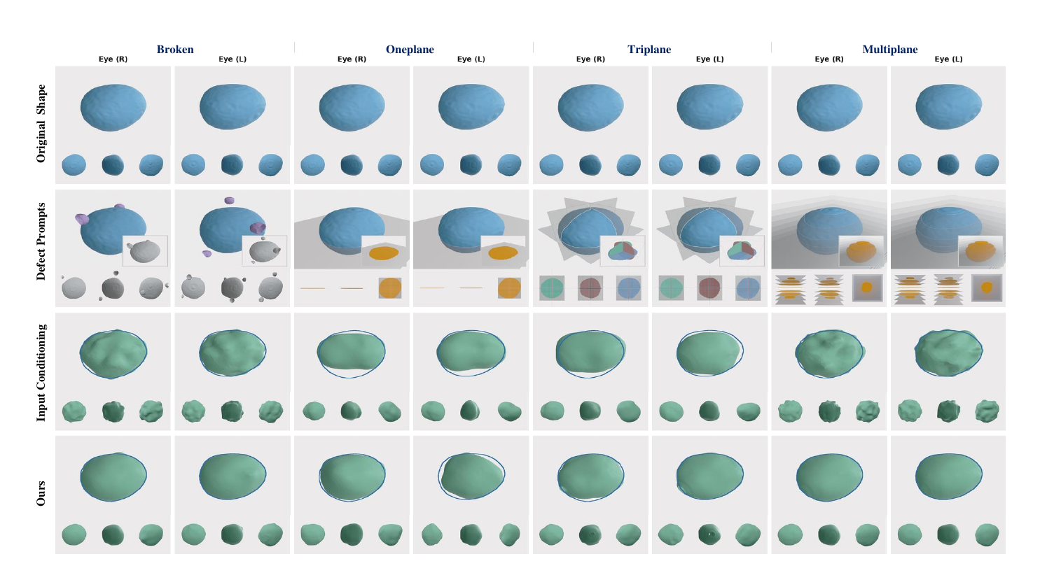 Zero-shot shape completion on a 3D eyeball dataset under different defect prompts.